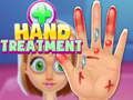 Spel Handbehandeling aanlyn Spel Handbehandeling aanlyn